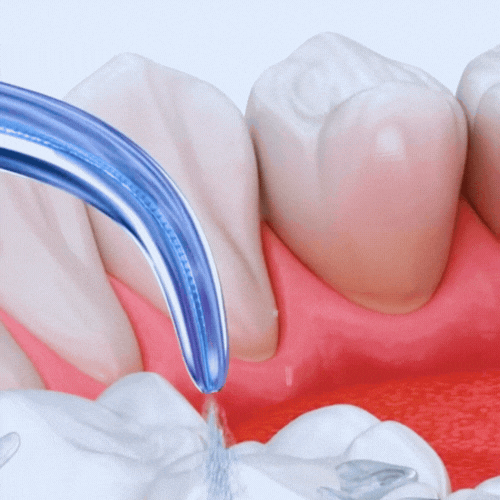 HydroSmile - Irrigador Dental Portátil