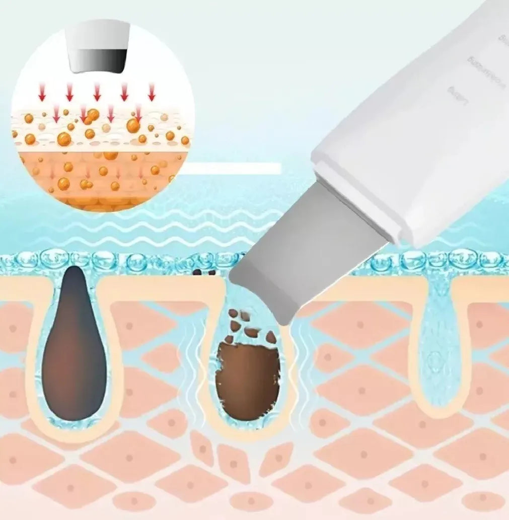 Paleta Ultrasónica Facial Limpieza Profunda y Skincare en Casa